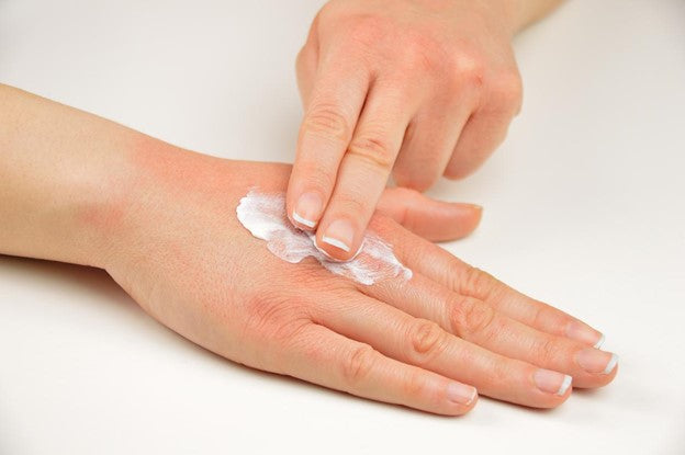 someone treating chapped hands with hand cream